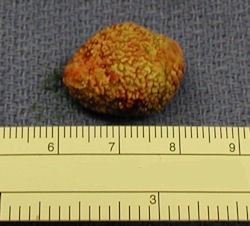 2010 05 19 14 35 56 512 2010 05 20 Salivarystone1