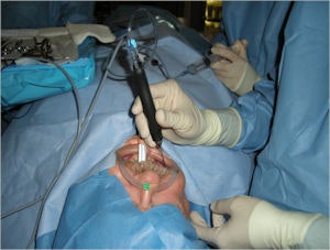 2010 05 19 14 35 57 669 2010 05 20 Salivarystone3