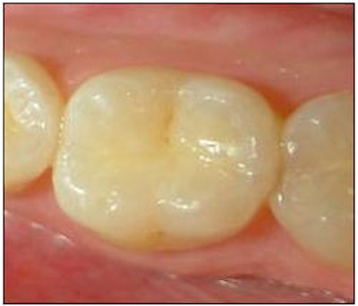 2010 06 01 12 05 16 768 2010 06 01 Loupes Image3