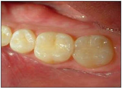 2010 06 01 12 05 17 513 2010 06 01 Loupes Image2