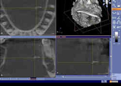 2010 07 06 13 44 32 380 2010 07 07 Cbct Salivary2 Thumb