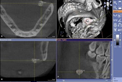 2010 07 06 14 43 40 205 2010 07 07 Cbct Salivary1b