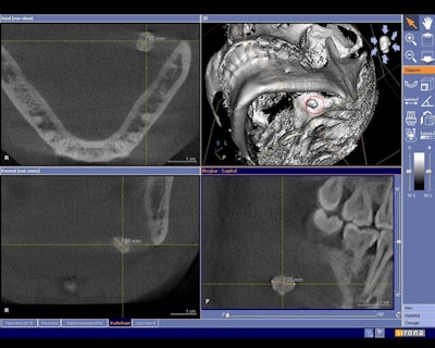 2010 07 06 14 43 40 205 2010 07 07 Cbct Salivary1b