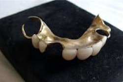 2010 07 29 14 50 01 833 2010 07 29 Churchill Dentures