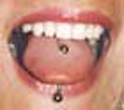2010 08 11 09 24 37 479 Tongue Piercing Barbell 70