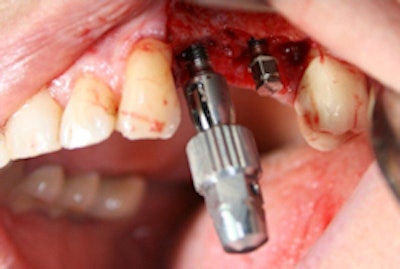 2010 08 12 09 45 55 846 Hermeler4