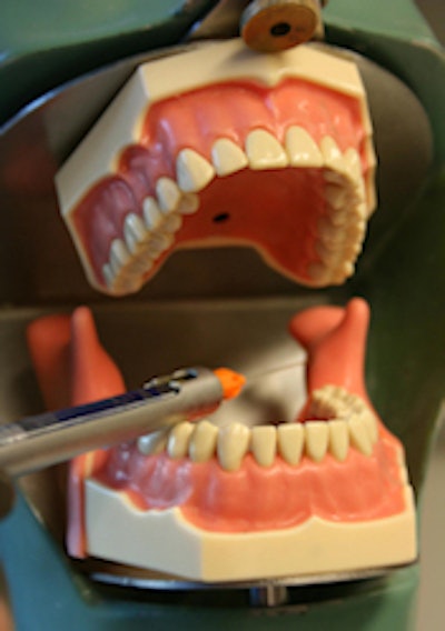 The Frasaco AG-3 training model modified by researchers at the Academic Centre for Dentistry Amsterdam. Image courtesy of Henk Brand, Ph.D.