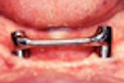 2010 08 25 11 08 26 423 Dental Bar 70