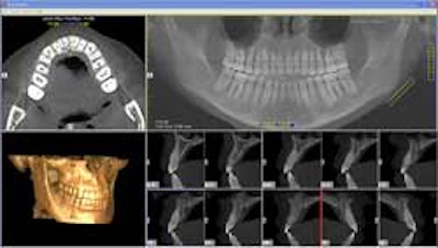 2010 08 27 13 05 52 389 2010 08 27 Cbct Implant2 Thumb
