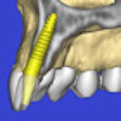 2010 08 27 13 05 53 939 2010 08 27 Cbct Implant Thumb