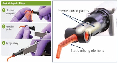 Figure 1: The Ketac Nano delivery system employs a swiveling, static mixing tip, eliminating the need for trituration.