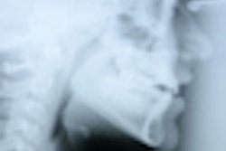 2010 09 30 16 39 11 497 Radiograph Profile 70