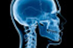 2010 10 18 10 55 26 11 Head Neck Xray 70