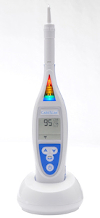 The CarieScan Pro caries detection device. All images courtesy of CarieScan.