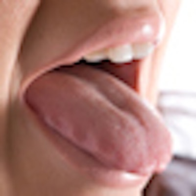 2010 10 25 11 51 36 297 Tongue 70