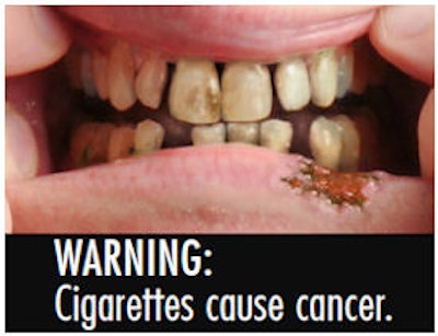 One of the FDA's 36 proposed designs for U.S. cigarette packages and advertising.