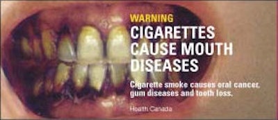 Canada has required graphic images on cigarette packages since 2000.