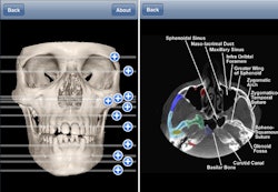 2010 11 19 11 08 02 527 2010 11 19 Ipano Thumb
