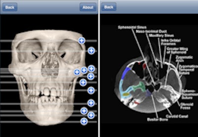 2010 11 19 11 08 02 527 2010 11 19 Ipano Thumb