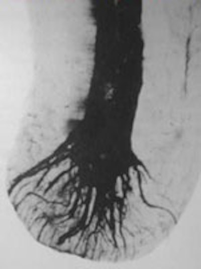 Figure 4: Apical 'delta' of a dog canine tooth.