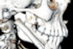 2010 12 21 11 19 07 233 2010 12 27 Jaw2 Thumb