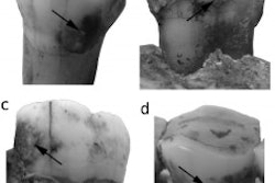 2010 12 28 10 55 32 675 Neandertalfig