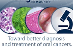 2011 01 03 12 41 22 475 Oral Cancer Highlight