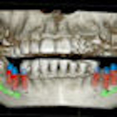 2009 04 27 10 47 12 770 Cbct Thumb 70