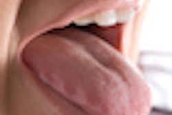2010 10 25 11 51 36 297 Tongue 70
