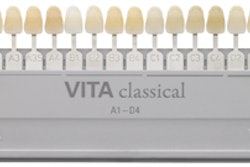 2011 02 15 17 43 16 290 Vident Vita Classical Shade Guide