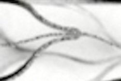2011 03 08 11 44 39 341 Saf Lattice Thumb
