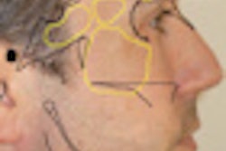 2011 03 15 16 42 00 268 2011 03 16 Digital Tool Thumb2
