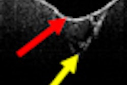 2011 03 22 16 14 57 131 Oct2 70