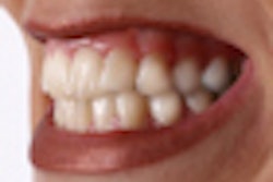 2011 03 24 13 53 26 202 Angry Smile Mouth 70