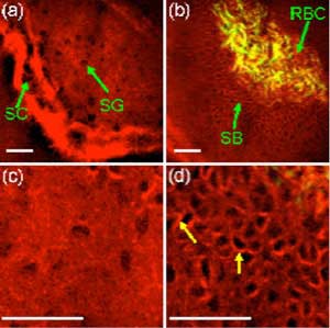 (a) Harmonic generation imaging of oral mucosa showing the stratum cornea (SC) and the stratum granulosa (SG) in the keratinized oral mucosa. (b) The stratum basale (SB) shows clear cell-cell junction among kertinocytes, and red blood cells (RBC) could be visualized in the blood vessels of the lamina propria. (c) Higher magnification of the stratum cornea as compared with the (d) stratum basale. The arrows indicate cell-cell junction. Images courtesy of Dr. Dar-Bin Shieh.