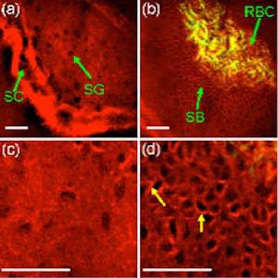 (a) Harmonic generation imaging of oral mucosa showing the stratum cornea (SC) and the stratum granulosa (SG) in the keratinized oral mucosa. (b) The stratum basale (SB) shows clear cell-cell junction among kertinocytes, and red blood cells (RBC) could be visualized in the blood vessels of the lamina propria. (c) Higher magnification of the stratum cornea as compared with the (d) stratum basale. The arrows indicate cell-cell junction. Images courtesy of Dr. Dar-Bin Shieh.