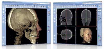 The Promax 3D Proface CBVT system by Planmeca.