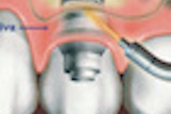 2011 04 05 15 37 48 493 2011 04 06 Spectroscopy Thumb