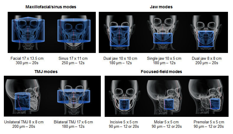 2011 05 19 14 05 10 886 Carestream Cs 9300 1