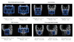 The CS 9300-1 features up to seven selectable fields-of-view for 3D images