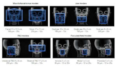 The CS 9300-1 features up to seven selectable fields-of-view for 3D images