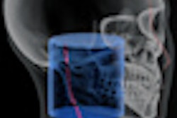 2011 05 19 14 05 14 998 Carestream Cs 9300 1 70