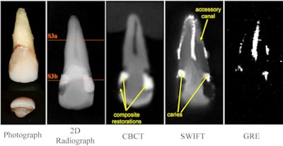 2011 06 09 10 52 16 892 2011 06 10 Swift Mri