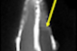 2011 06 09 10 53 16 641 2011 06 10 Swift Mri Thumb2