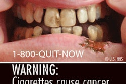 2011 06 21 10 23 41 551 Fda Cigarette Warning