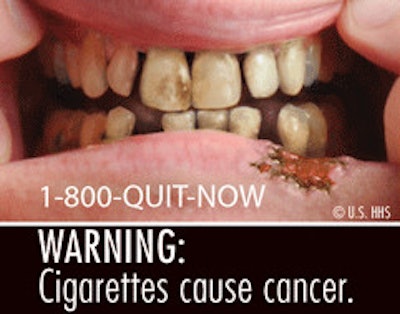 2011 06 21 10 23 41 551 Fda Cigarette Warning