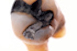 2009 11 11 10 32 41 678 Amalgam Tooth 70