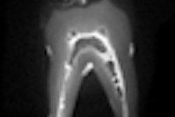 2011 02 22 16 41 13 991 2011 02 23 Mri Swift Thumb