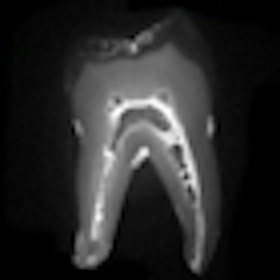 2011 02 22 16 41 13 991 2011 02 23 Mri Swift Thumb