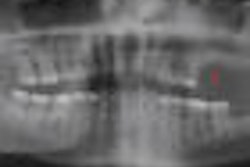 2011 08 10 13 33 47 224 Pano Xray 70